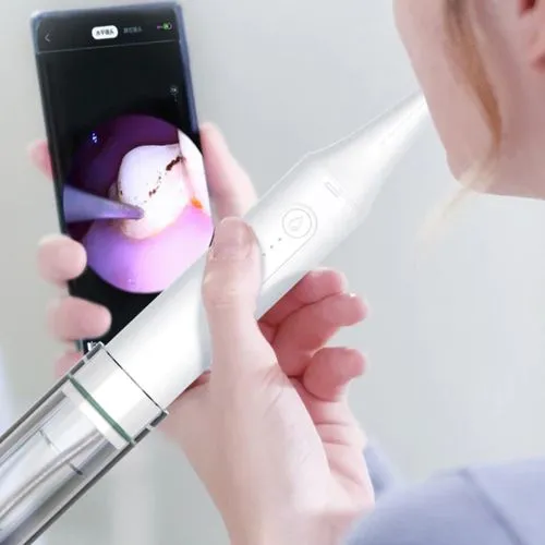 Ультразвуковой ирригатор-скалер для удаления зубного камня Xiaomi Sunuo T13 Pro Smart Visual Scaler фото 4